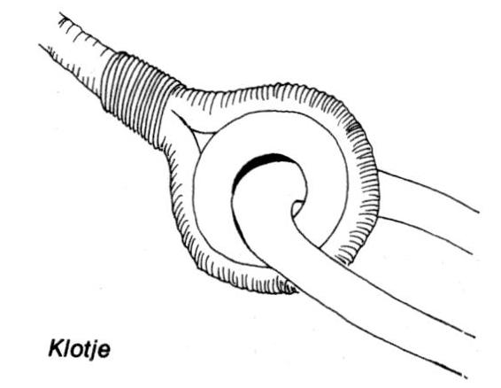 Klotje